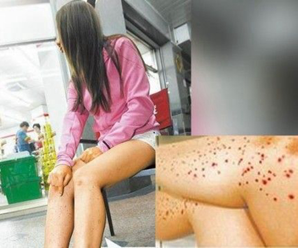 妊娠合併梅毒阻斷效果