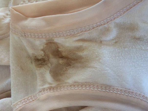 白帶帶有褐色分泌物 (52) 