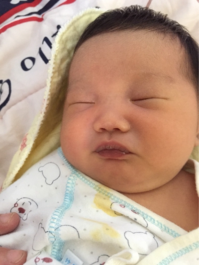 新生兒嘴唇發紫 (43) 