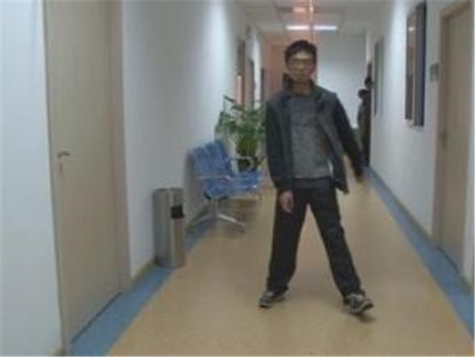 腦供血不足引發短暫性共濟失調