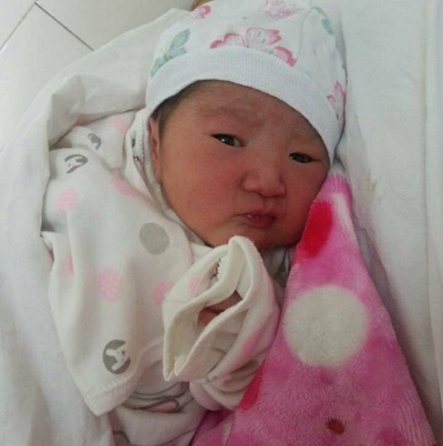 新生兒嘴唇發紫 (36) 