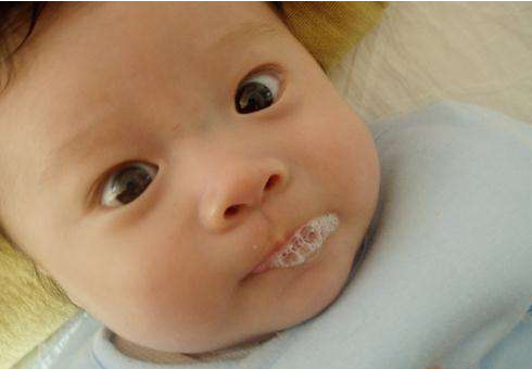 新生兒肺炎吐泡泡 (50) 