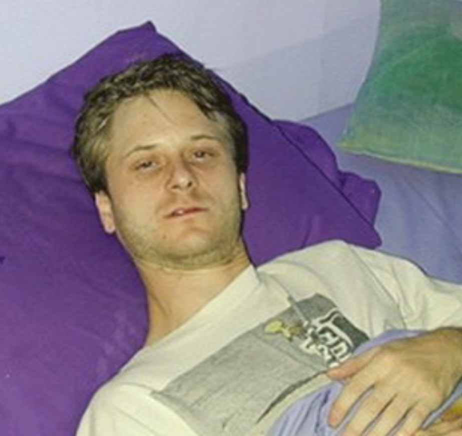 腹股溝淋巴瘤症狀