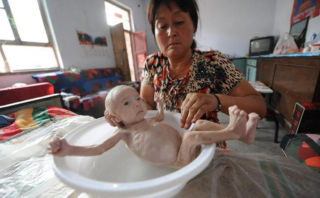 身體消瘦的原因 (79) 