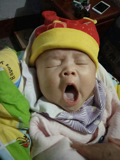 寶寶鵝口瘡 (65) 