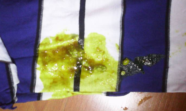 新生兒腹瀉大便