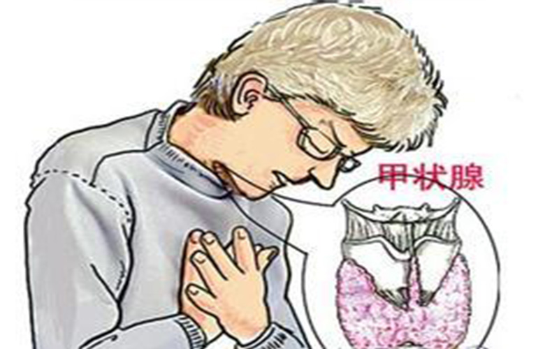 甲狀腺瘤的症狀 