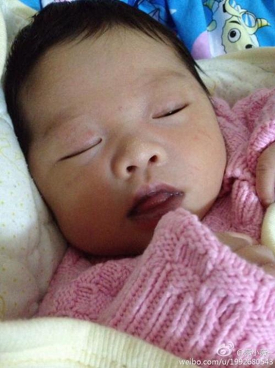 嬰兒嘴唇發紫 (52) 