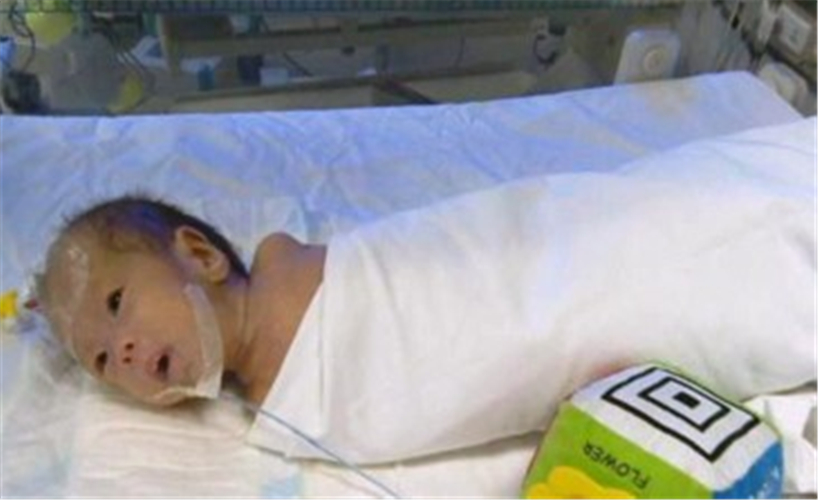 先天性喉喘鳴治療的