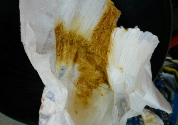 新生兒腹瀉大便