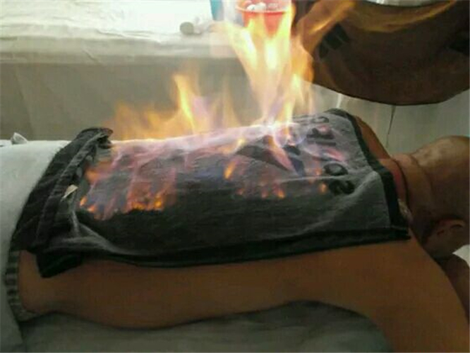 中醫治療腦血栓