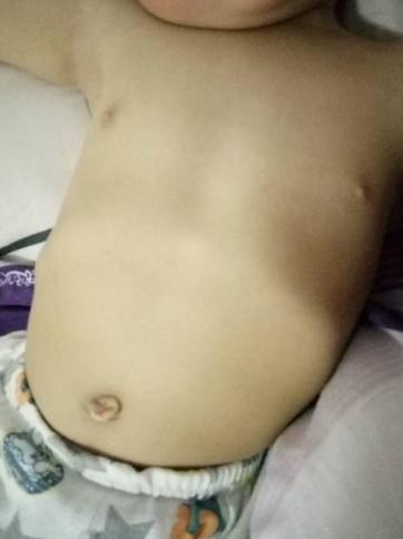 寶寶雞胸圖 (57) 