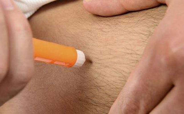 胰島素注射部位 (50) 