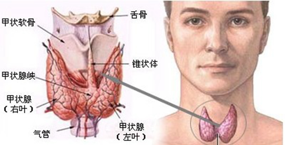 橋本甲狀腺炎左右頁結節