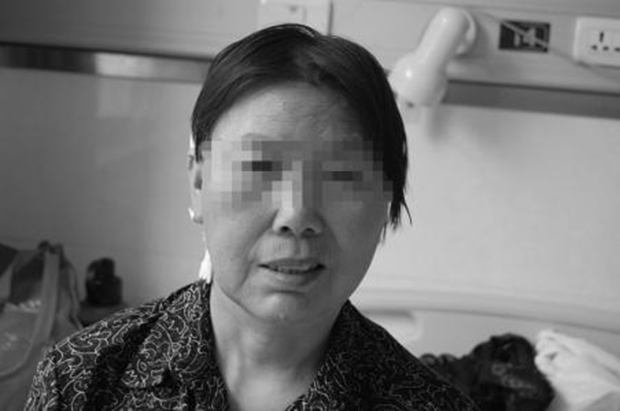 女性面肌痙攣術後