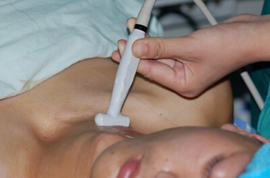 橋本甲狀腺炎治療中