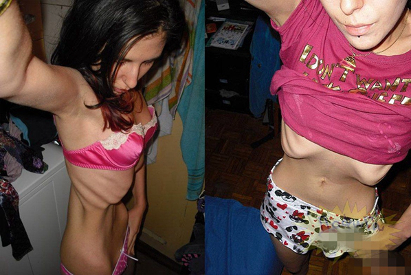 身體消瘦的原因 (78) 