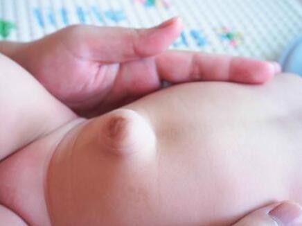 男寶寶疝氣的症狀