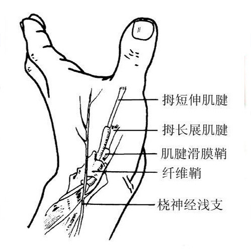 手腕腱鞘炎症狀 