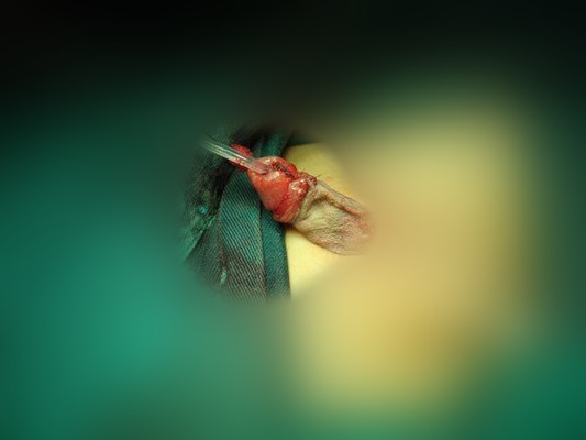 尿道口紅腫 (50) 