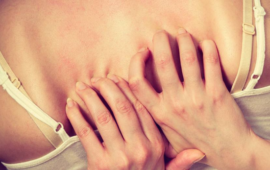 孕婦膽汁淤積症狀