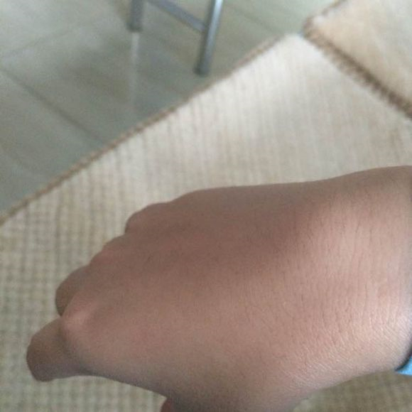 右手的手腕腱鞘炎