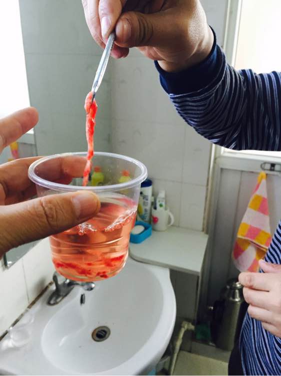 舌下排出的腦血栓