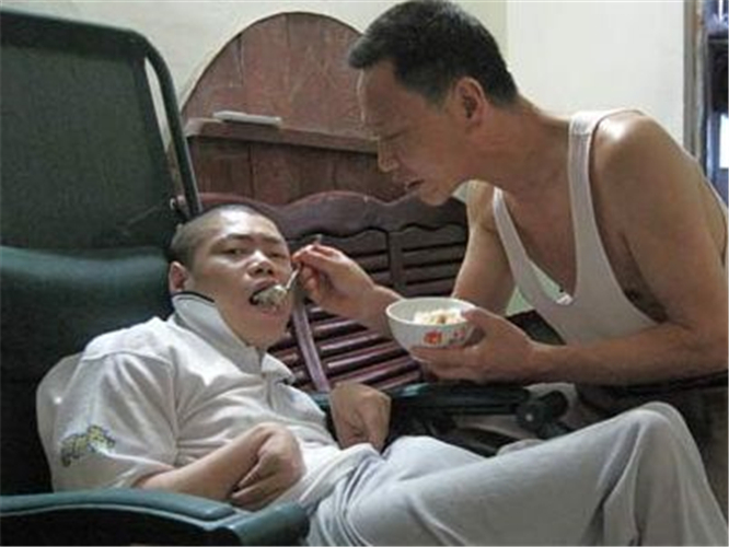 輕度腦萎縮護理