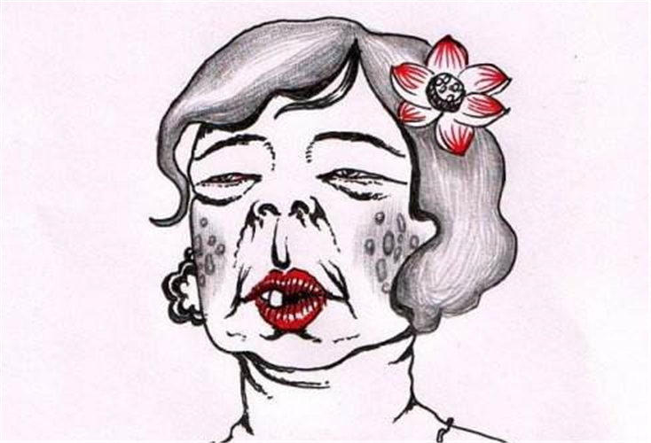 老年斑症狀卡通