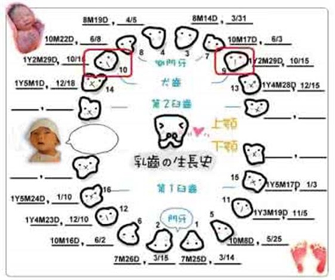 乳牙換牙順序 (38) 