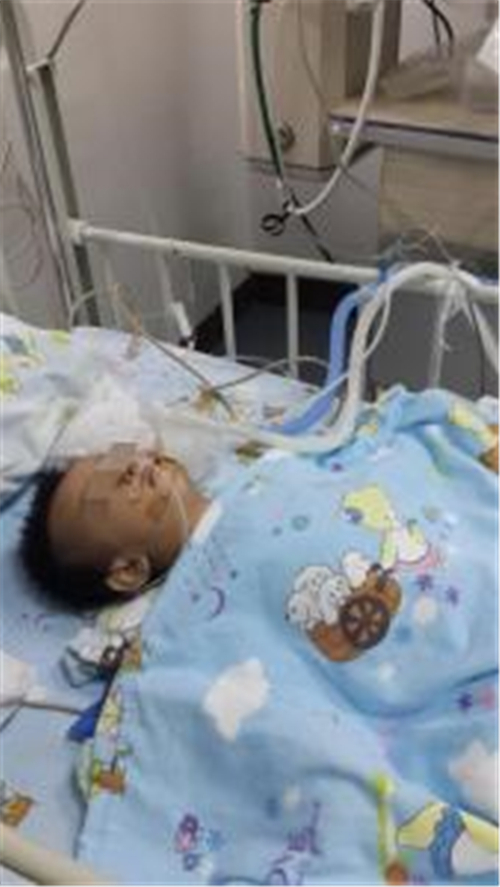 先天性喉喘鳴住院治療