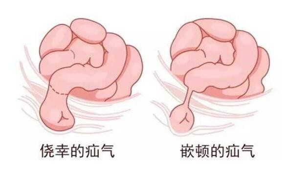 男寶寶疝氣的症狀