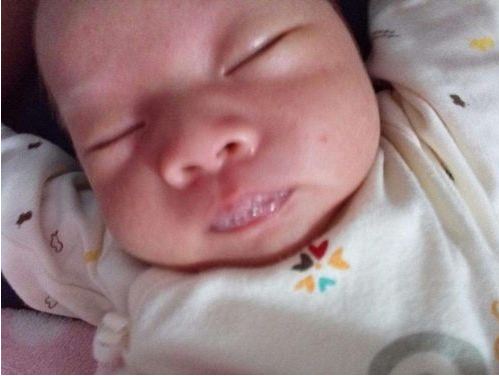 新生兒肺炎吐泡泡 (45) 