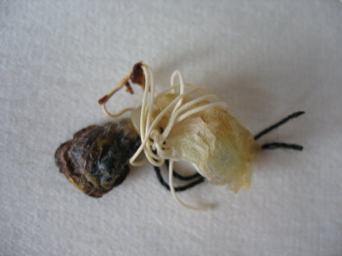 新生兒肚臍脫落圖 (9) 