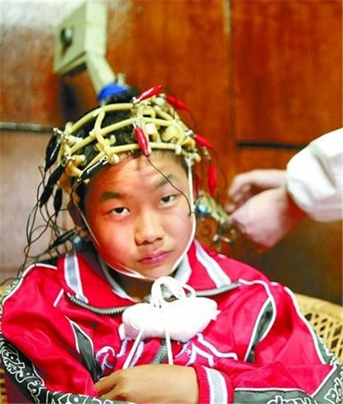 外傷引發的腦萎縮治療