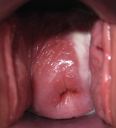 子宮肥大圖 (48) 