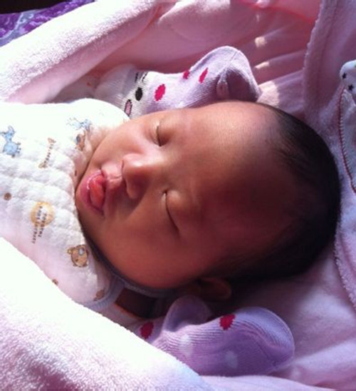 新生兒唐氏綜合徵