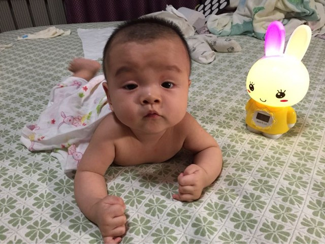 幼兒痙攣性斜頸該怎麼辦