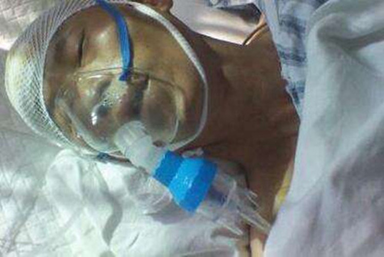 腦出血手術後的危險期